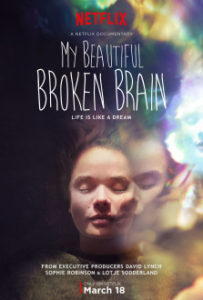 my-beautiful-broken-brain